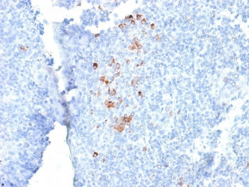 IHC testing of FFPE human tonsil with recombinant human IgG antibody (clone rIG266). Required HIER: