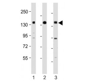 RON Antibody / MST1R (Center Region)
