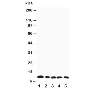 MIP-1 beta Antibody