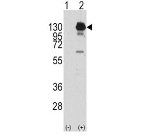 Platelet Derived Growth Factor Receptor alpha Antibody (PDGFRA)