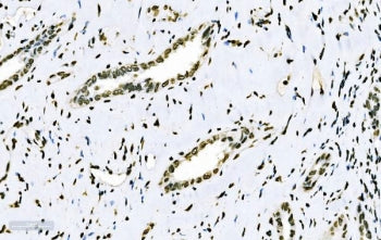 SF1 Antibody / Splicing factor 1