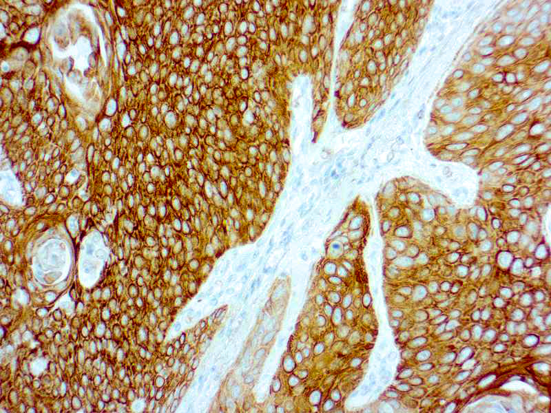 Cytokeratin 5/6