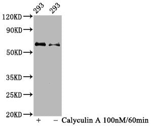 Phospho-AKT1 (Ser473) Recombinant Monoclonal Antibody