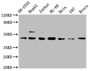 CCR9 Recombinant Monoclonal Antibody