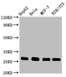CDKN1B Recombinant Monoclonal Antibody