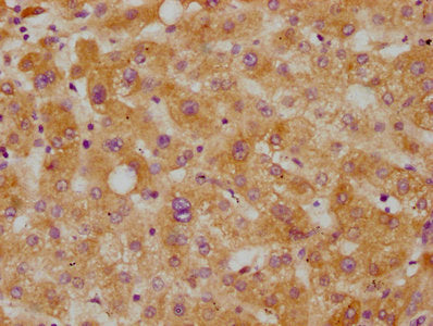 CETP Antibody