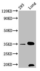 CNN1 Antibody