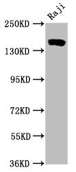 CD21 Recombinant Monoclonal Antibody