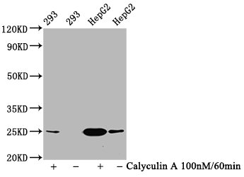 Phospho-EIF4E (S209) Antibody