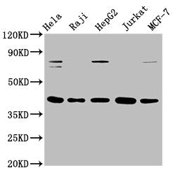 FEN1 Recombinant Monoclonal Antibody