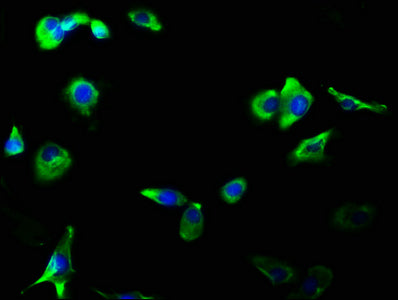GRIA2/GRIA3 Recombinant Monoclonal Antibody
