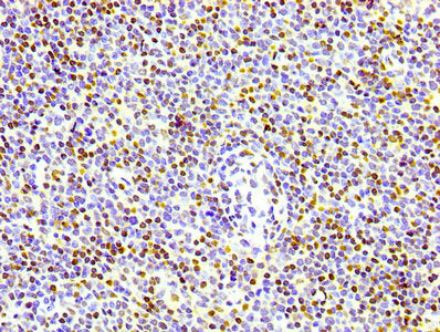 Phospho-Histone H1.4 (T17) Antibody