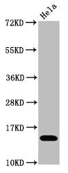 Acetyl-Histone H3.1(K4)Antibody