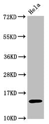 Acetyl-Histone H3.1 (K56) Antibody