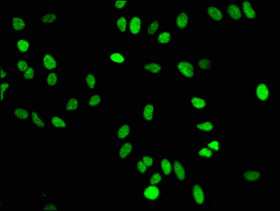 Mono-methyl-Histone H4 (K16) Recombinant Monoclonal Antibody