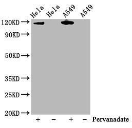 Phospho-JAK2 (Y1007 + Y1008) Antibody
