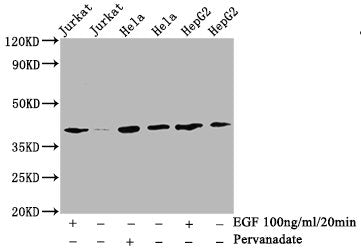 Phospho-LAT (Y191) Recombinant Monoclonal Antibody