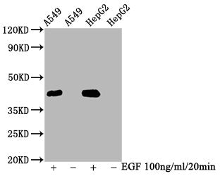 Phospho-MAPK3 (T202) + MAPK1 (T185) Recombinant Monoclonal Antibody