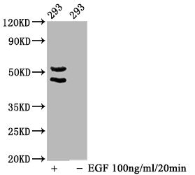 Phospho-MAPK8/MAPK9/MAPK10 (T183/T183/T221) Antibody
