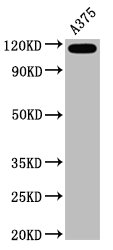 CD146 Antibody