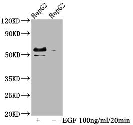 Phospho-MYC (T58+S62) Antibody