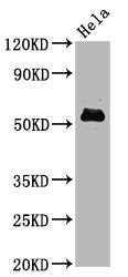 Phospho-MYC (S62) Recombinant Monoclonal Antibody