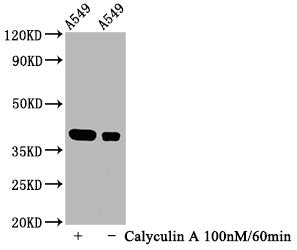 Phospho-NFKBIA (S32) Recombinant Monoclonal Antibody
