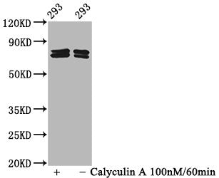 Phospho-PAK4/PAK5/PAK6 (S474/S560/S602) Antibody