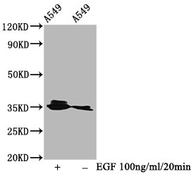 Phospho-PPP2CA (Y307) Antibody