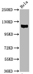 Phospho-PTK2 (Y397) Antibody