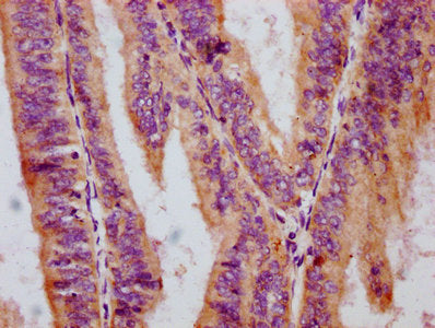 Phospho-RAF1 (S259) Antibody