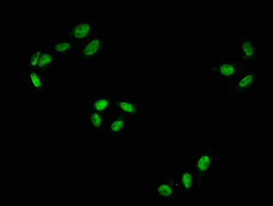 Phospho-RAF1 (S43) Recombinant Monoclonal Antibody