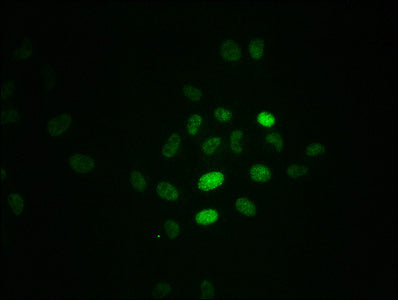 Phospho-RPA2 (T21) Recombinant Monoclonal Antibody