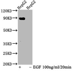 Phospho-STAT5A (Y694) Recombinant Monoclonal Antibody