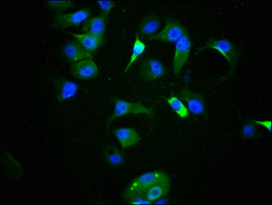 Phospho-TP53 (S9) Recombinant Monoclonal Antibody