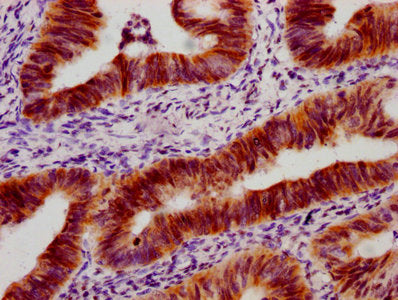 Phospho-TP53 (S33) Antibody