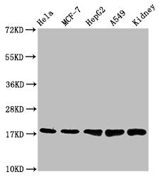 TSPO Recombinant Monoclonal Antibody