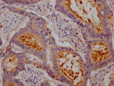 CEACAM1 Recombinant Monoclonal Antibody