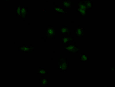 INSR Recombinant Monoclonal Antibody