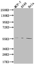 FADS1 Recombinant Monoclonal Antibody