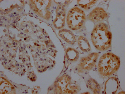 SIRT5 Recombinant Monoclonal Antibody