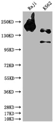 INPP5D Recombinant Monoclonal Antibody