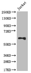 SLC2A3 Recombinant Monoclonal Antibody