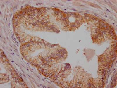 BRAF Recombinant Monoclonal Antibody