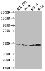 AHCY Recombinant Monoclonal Antibody