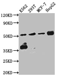 CHEK1 Recombinant Monoclonal Antibody