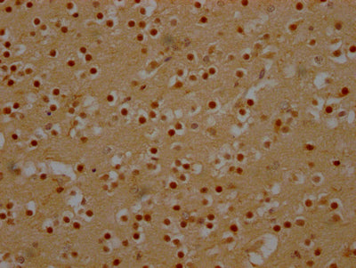DDX6 Recombinant Monoclonal Antibody