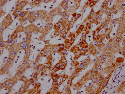ANGPT2 Recombinant Monoclonal Antibody