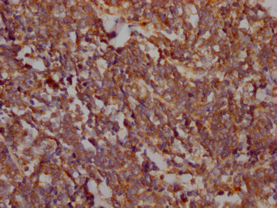 PTK2 Recombinant Monoclonal Antibody