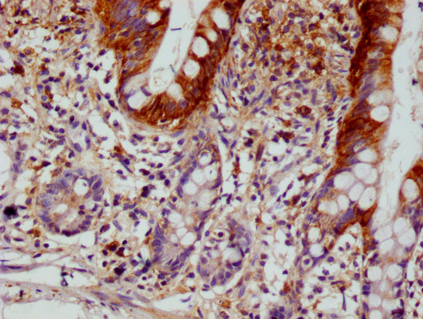 SCIN Recombinant Monoclonal Antibody